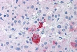 EPHX2 Antibody, Novus Biologicals 50 &mu;g; Unconjugated:Antibodies, Polyclonal